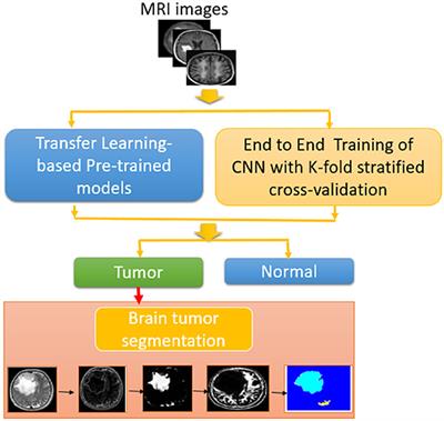 Efficient framework for brain tumor detection using different deep learning techniques